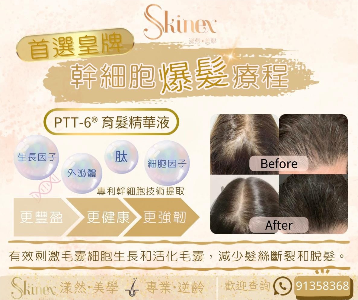 幹細胞爆髮療程 PTT-6 育髮精華液療程前後對比